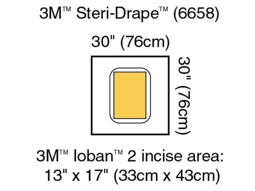 3M™ Steri-Drape™ Sterile Large Pouch Surgical Drape